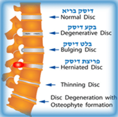 פריצת דיסק